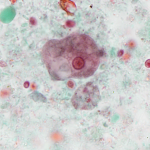 Case386_D.jpg Figure D