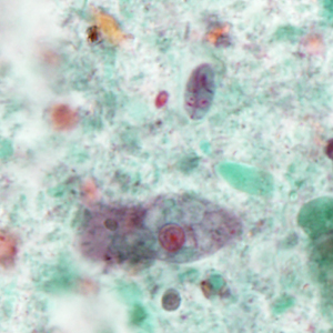 Case386_E.jpg Figure E