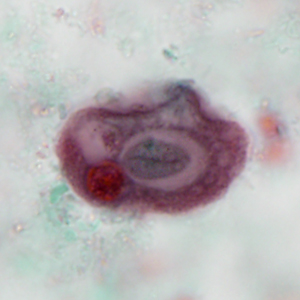 Case386_F.jpg Figure F