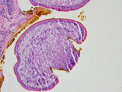 Figure B