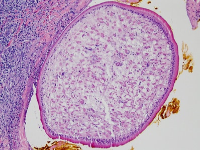 Figure C