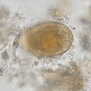 A 42-year-old man with a history of living abroad in Peru for a year returned home to the United States. He reported to his health care provider that he had been experiencing vague intermittent abdominal discomfort. 