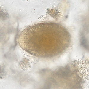Figure B
