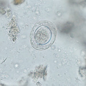 Figure E