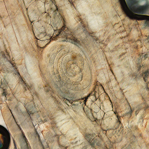 February - 2015 - Case #389 A hunter presented with abdominal pain and fever, which later developed into difficulty breathing with a nonproductive cough and rash.