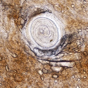 Figure B