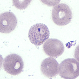 Figure B