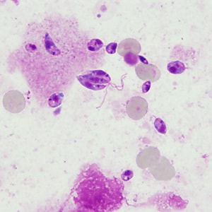 Figure B