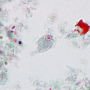 Case395_B.jpg Figure B