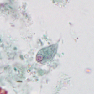 Case395_C.jpg Figure C