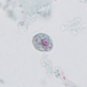 Case395_D.jpg Figure D