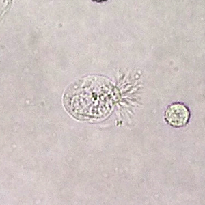 Case396_B.jpg Figure B