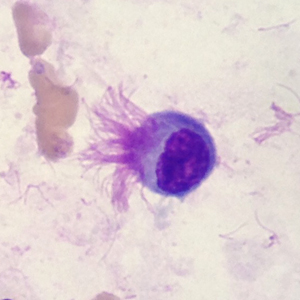 Case396_D.jpg Figure D