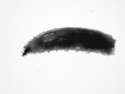 A worm-like object approximately 11 mm in length was recovered from a PEG site (percutaneous endoscopic gastrostomy) of a 68-year-old patient and submitted to the state health department for identification. 