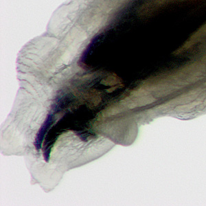 Case397_B.jpg Figure B