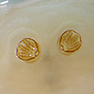 Case397_D.jpg Figure D