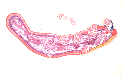 July - 2015 - Case #399 A skin biopsy specimen was collected from the clavicle region of a 45-year-old male who presented with what appeared to be a pigmented lesion. The patient resides in Kentucky and has no known international travel.