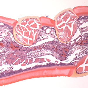 Case399_B.jpg Figure B
