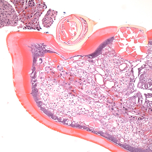 Case399_C.jpg Figure C