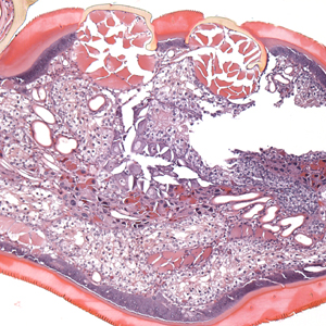 Case399_D.jpg Figure D