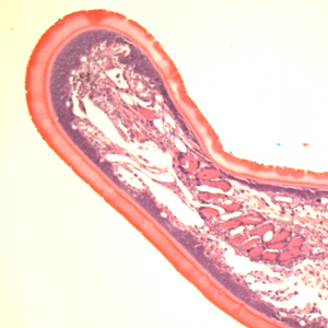 Case399_E.jpg Figure E