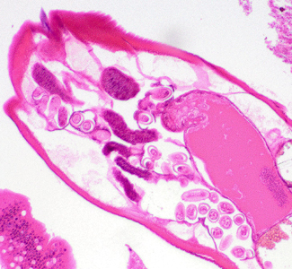 Case400_B.jpg Figure B