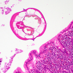 Case400_C.jpg Figure C