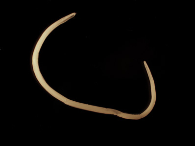 August - 2015 - Case #401 A worm approximately three centimeters long was observed and removed during a routine colonoscopy of a 54-year-old man from Scandinavia. The worm was sent to the CDC-DPDx Team for identification.