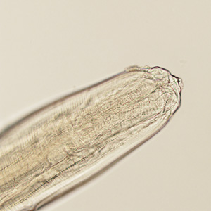 Case401_B.jpg Figure B