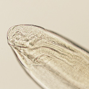 Case401_C.jpg Figure C