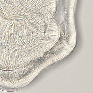 Case401_E.jpg Figure E