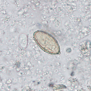 A stool specimen was collected from a 28-year-old man from China as part of a refugee health screening program. The stool was collected in 10% formalin and a formalin-ethyl acetate (FEA) concentration was performed. 