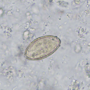 Case402_B.jpg Figure B