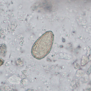 Case402_C.jpg Figure C