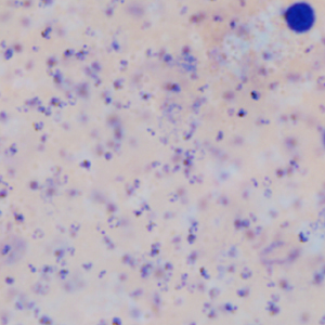 Case403_B.jpg Figure B