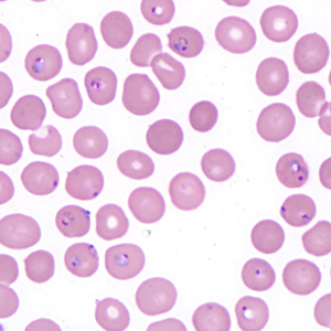 Case403_C.jpg Figure C