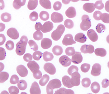 Case403_D.jpg Figure D