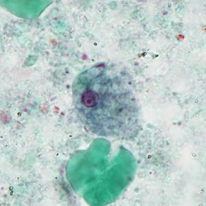 A 37-year-old primate research worker sought medical attention after nearly a week of abdominal discomfort, cramping, and diarrhea. 