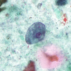 Case404_B.jpg Figure B