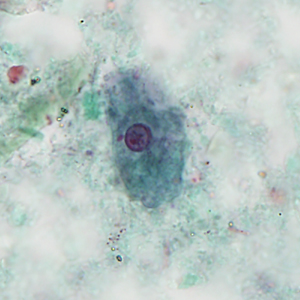 Case404_C.jpg Figure C