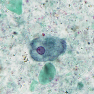 Case404_D.jpg Figure D