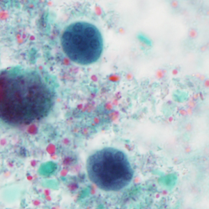 Case404_E.jpg Figure E