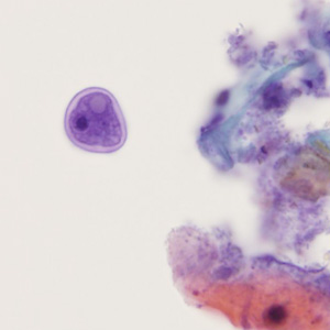 Case405_B.jpg Figure B