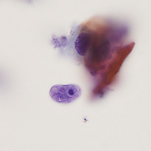 Case405_C.jpg Figure C