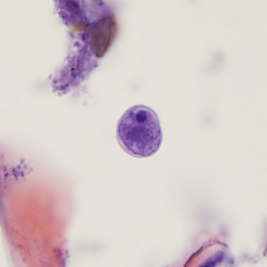 Case405_E.jpg Figure E