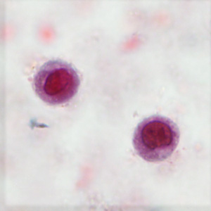 Case406_B.jpg Figure B