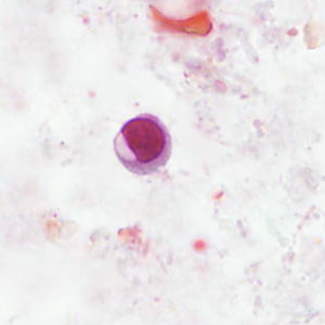 Case406_C.jpg Figure C