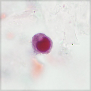 Case406_D.jpg Figure D