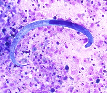 Figure B