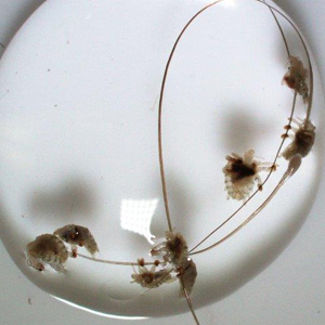 November - 2015 - Case #408 A 65-year-old man from rural Canada presented with pruritus on his chest; he mentioned that even with frequent bathing the symptoms persisted.